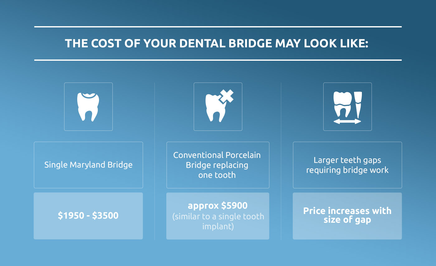 cost of dental bridge infographic